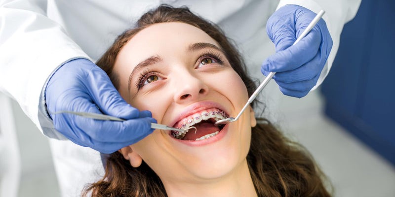 7 Amazing composite fillings Blue Springs Hacks